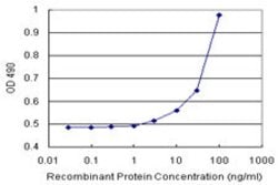 GLMN (Human) Matched Antibody Pair, Abnova 1 Set; Unconjugated:Antibodies