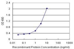 DUSP12 (Human) Matched Antibody Pair, Abnova 1 Set; Unconjugated:Antibodies