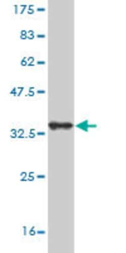 SORCS3, Mouse anti-Human, Clone: 3B12, Abnova 100&mu;g; Unconjugated:Antibodies,