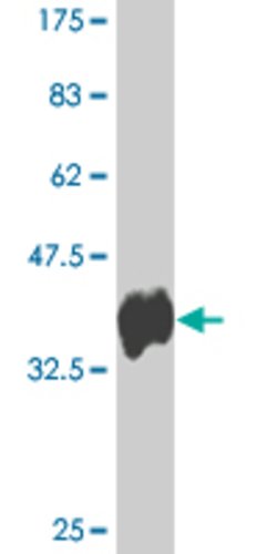 PUM2, Mouse anti-Human, Clone: 1E10, Abnova 100&mu;g; Unconjugated:Antibodies,