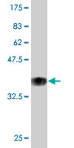 POU2F3, Mouse anti-Human, Clone: 6D1, Abnova 100&mu;g; Unconjugated:Antibodies,
