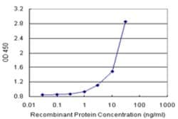 FGF21 (Human) Matched Antibody Pair, Abnova&trade;