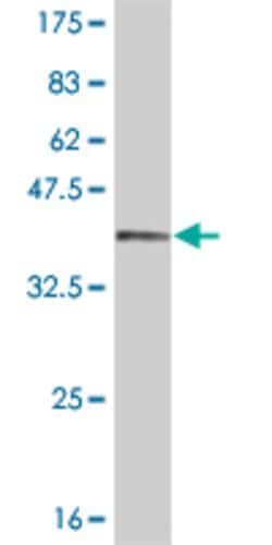 RAX, Mouse anti-Human, Clone: 1E2, Abnova 100&mu;g; Unconjugated:Antibodies,