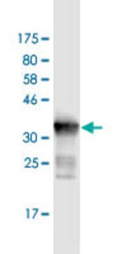DDX41, Mouse anti-Human, Clone: 1D4, Abnova 100&mu;g; Unconjugated:Antibodies,