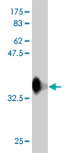 RFWD3, Mouse anti-Human, Clone: 6B4, Abnova 100 &mu;g | Buy Online | Abnova | Fisher Scientific