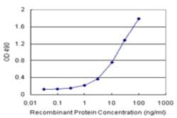 RIOK2 (Human) Matched Antibody Pair, Abnova&trade;