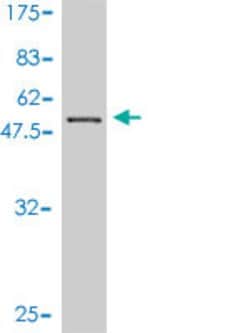 CENPN, Mouse anti-Human, Clone: 4A5-1C11, Abnova 100&mu;g; Unconjugated:Antibodies,