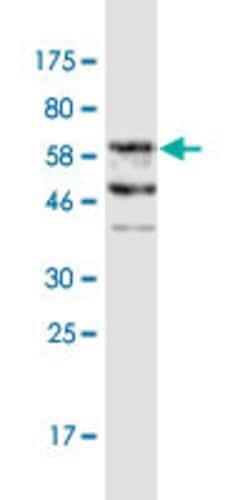 FAM62B, Mouse anti-Human, Clone: 1E10, Abnova 100&mu;g; Unconjugated:Antibodies,
