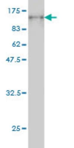 PCDHB16, Mouse anti-Human, Clone: 3H1, Abnova 50&mu;g; Unconjugated:Antibodies,