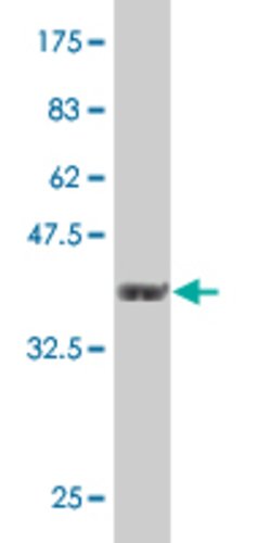 PJA1, Mouse anti-Human, Clone: 3E10, Abnova 100&mu;g; Unconjugated:Antibodies,