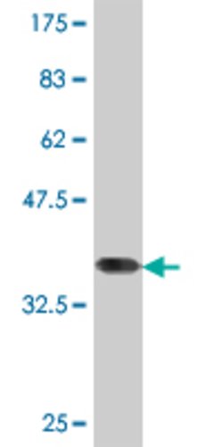 NSD1, Mouse anti-Human, Clone: 3E6, Abnova 100&mu;g; Unconjugated:Antibodies,