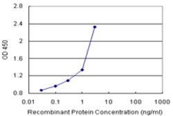 THTPA (Human) Matched Antibody Pair, Abnova 1 Set; Unconjugated:Antibodies