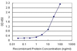 ASB9 (Human) Matched Antibody Pair, Abnova 1 Set; Unconjugated:Antibodies