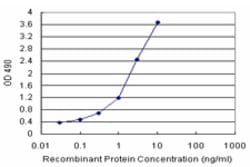 COMMD1 (Human) Matched Antibody Pair, Abnova 1 Set; Unconjugated:Antibodies