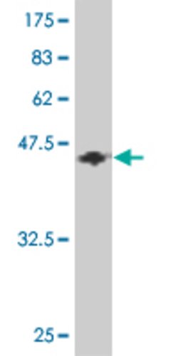 ARX, Mouse anti-Human, Clone: 1A4, Abnova 100&mu;g; Unconjugated:Antibodies,