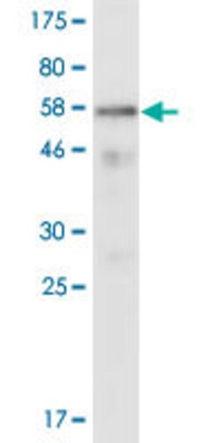 EV71 VP1, Mouse anti-Viruses, Clone: 4D3, Abnova 100&mu;g; Unconjugated:Antibodies,