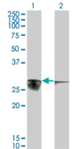 Calcyclin Binding Protein Mouse Anti-Human, Clone: 2E3, Abnova 100 &mu;g;