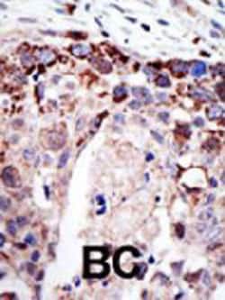 Ataxin 3 Rabbit Anti-Human, Polyclonal, Abnova 400 &mu;L; Unconjugated:Antibodies,