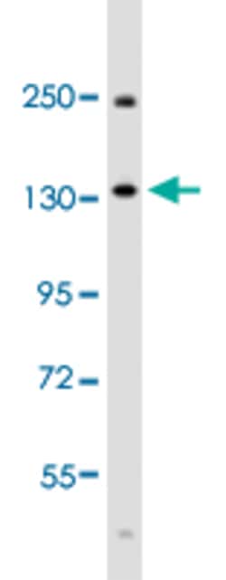 Bone Morphogenetic Protein Receptor, Type II (Serine/Threonine Kinase) Rabbit Anti-Human, Polyclonal, Abnova&Trade;