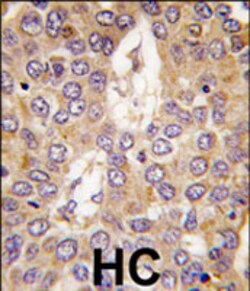 Casein Kinase 1, Gamma 2 Rabbit Anti-Human,Mouse, Polyclonal, Abnova 400