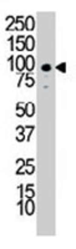 Discoidin Domain Receptor Tyrosine Kinase 1 Rabbit Anti-Human, Polyclonal,