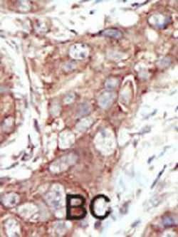 Discoidin Domain Receptor Tyrosine Kinase 1 Rabbit Anti-Human, Polyclonal,