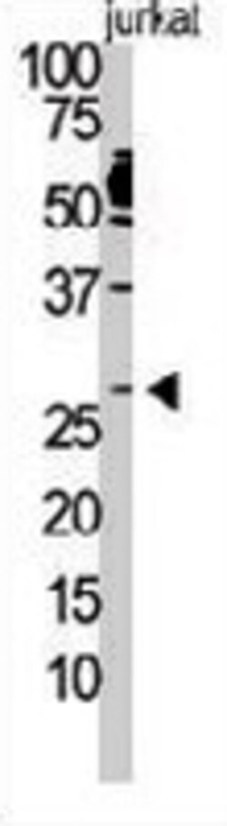 Dickkopf Homolog 2 (Xenopus Laevis) Rabbit Anti-Human, Polyclonal, Abnova
