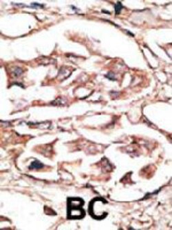 Dickkopf Homolog 2 (Xenopus Laevis) Rabbit Anti-Human, Polyclonal, Abnova