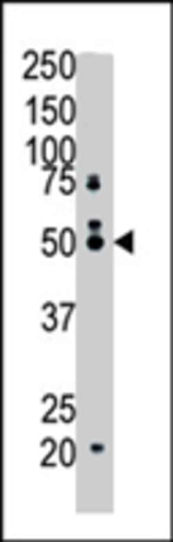 Farnesyl-Diphosphate Farnesyltransferase 1 Rabbit Anti-Human,Mouse, Polyclonal,