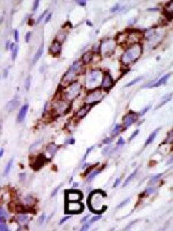 G Protein-Coupled Receptor Kinase 5 Rabbit Anti-Human,Mouse, Polyclonal,