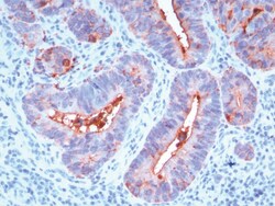 Carcinoembryonic Antigen / CD66 Mouse, Clone: C66/195, enQuireBio 100 &mu;g:Antibodies,