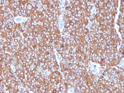 Chromogranin A / CHGA Mouse, Clone: LK2H10 + PHE5 + CGA/414, enQuireBio