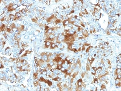 Chromogranin A / CHGA Mouse, Clone: CHGA/765, enQuireBio 100 &mu;g:Antikörper