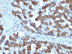 CPS1 / Carbamoyl-Phosphate Synthetase Mouse, Clone: SPM615, enQuireBio