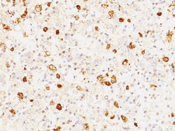 FSH-beta Mouse, Clone: FSHb/1062, enQuireBio 100 &mu;g:Antibodies, Monoclonal