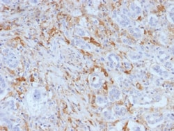 Ferritin, Light Chain Mouse, Clone: FTL/1388, enQuireBio:Antibodies:Primary