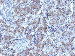 Glypican-3 Rabbit, Clone: GPC3/1534R, enQuireBio:Anticuerpos:Anticuerpos