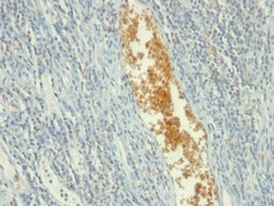 AMP Deaminase, Isoform E Mouse, Clone: AMPD3/901, enQuireBio 100 &mu;g | Buy Online | EnquireBio | Fisher Scientific