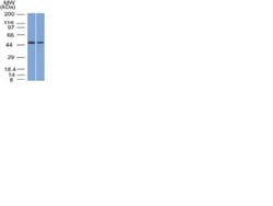 FOXA1 / HNF3A Mouse, Clone: FOXA1/1512, enQuireBio:Antibodies:Primary Antibodies