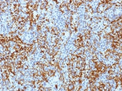 CD61 / Integrin beta-3 Mouse, Clone: ITGB3/1713, enQuireBio:Anticuerpos:Anticuerpos