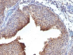Cytokeratin 6 Mouse, Clone: LHK6; same as LHK6B, enQuireBio 100 &mu;g | Buy Online | EnquireBio | Fisher Scientific