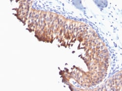 Cytokeratin 10 Mouse, Clone: DE-K10, enQuireBio 100 &mu;g | Buy Online | EnquireBio | Fisher Scientific