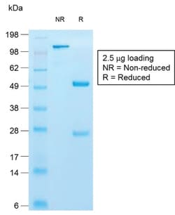 Cytokeratin 10 (KRT10) (Suprabasal Epithelial Marker) Rabbit, Clone: KRT10/1990R,