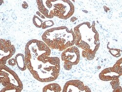 Cytokeratin 18 Mouse, Clone: DE-K18, enQuireBio 100 &mu;g:Antibodies, Monoclonal