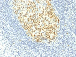 MCM7 Mouse, Clone: MCM7/1467, enQuireBio:Anticuerpos:Anticuerpos primarios