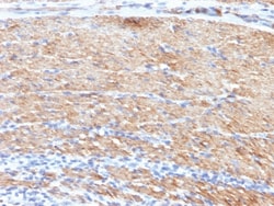 Smooth Muscle Myosin Heavy Chain Mouse, Clone: MYH11/923 + SMMS-1, enQuireBio
