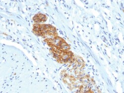 CD56 / NCAM1 / NKH1 Mouse, Clone: NCAM1/784, enQuireBio 100 &mu;g | Buy Online | EnquireBio | Fisher Scientific