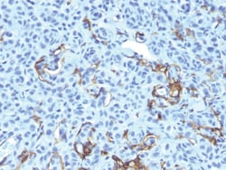 NGF-Receptor / CD271 Mouse, Clone: NGFR5 + NTR/912, enQuireBio 100 &mu;g:Antibodies,
