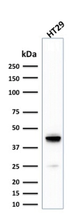 Cytokeratin 20 (KRT20) (Colorectal Epithelial Marker) Mouse, Clone: KRT20/1992,