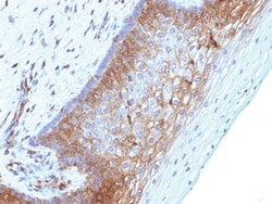 Beta-2 Microglobulin Mouse, Clone: B2M/1118, enQuireBio 100 &mu;g:Anticuerpos